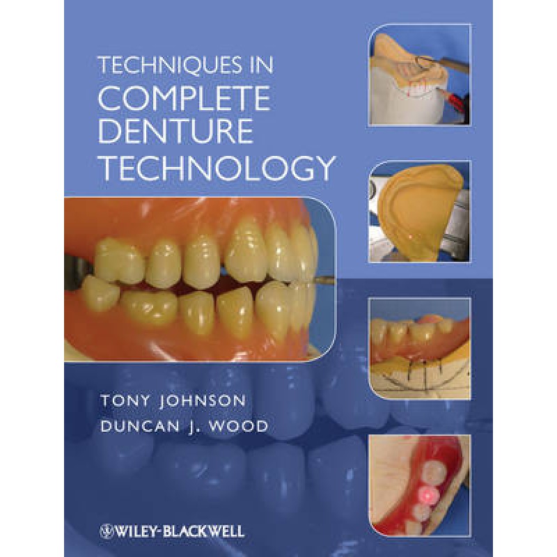 Techniques in Complete Denture Technology